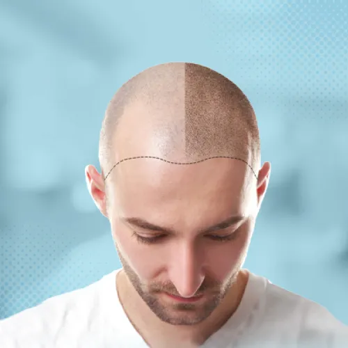 Kliniğin Güvenilirlik Algısı